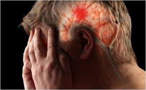 Đau nửa đầu gây nên những cơn đau dai dẳng